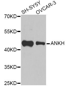 Rabbit anti-ANKH Polyclonal Antibody