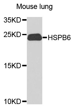 Rabbit anti-HSPB6 Polyclonal Antibody