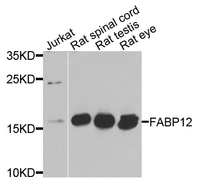 Rabbit anti-FABP12 Polyclonal Antibody