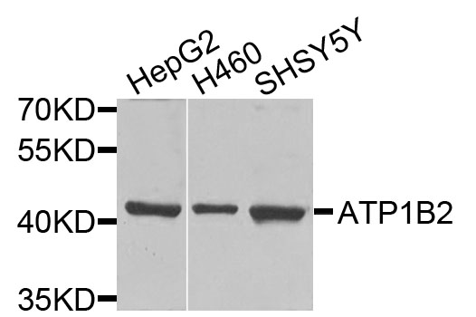 Rabbit anti-ATP1B2 Polyclonal Antibody