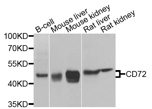 Rabbit anti-CD72 Polyclonal Antibody