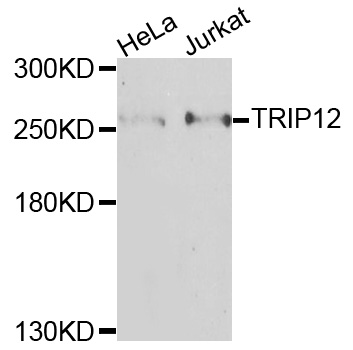 Rabbit anti-TRIP12 Polyclonal Antibody