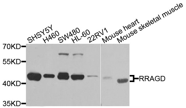 Rabbit anti-RRAGD Polyclonal Antibody