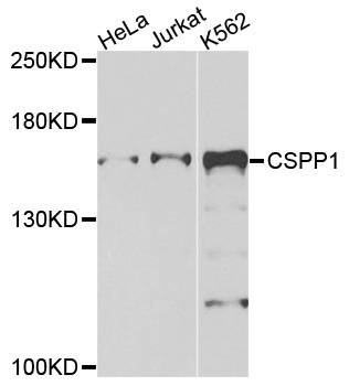 Rabbit anti-CSPP1 Polyclonal Antibody