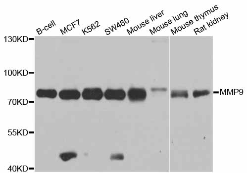 Rabbit anti-MMP9 Polyclonal Antibody