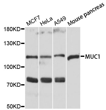 Rabbit anti-MUC1 Polyclonal Antibody