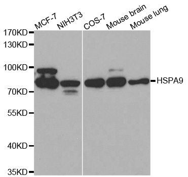 Rabbit anti-HSPA9 Polyclonal Antibody
