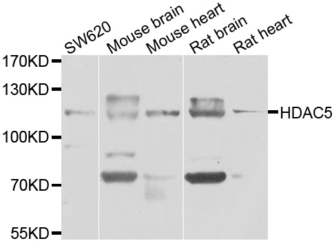 Rabbit anti-HDAC5 Polyclonal Antibody