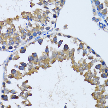 Rabbit anti-HDAC5 Polyclonal Antibody