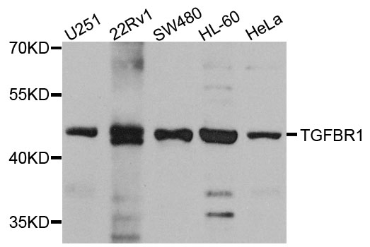 Rabbit anti-TGFBR1 Polyclonal Antibody