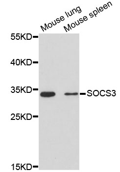 Rabbit anti-SOCS3 Polyclonal Antibody