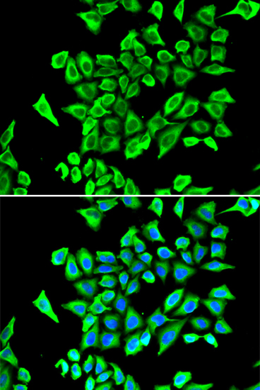 Rabbit anti-LCN2 Polyclonal Antibody