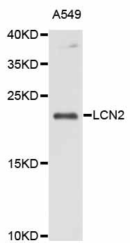 Rabbit anti-LCN2 Polyclonal Antibody