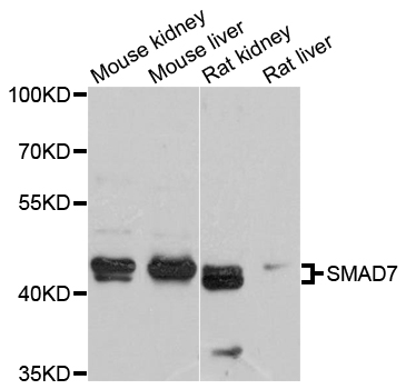 Rabbit anti-SMAD7 Polyclonal Antibody