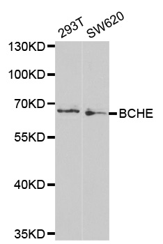Rabbit anti-BCHE Polyclonal Antibody