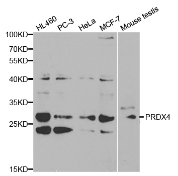 Rabbit anti-PRDX4 Polyclonal Antibody
