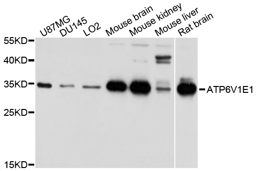 Rabbit anti-ATP6V1E1 Polyclonal Antibody