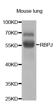 Rabbit anti-RBPJ Polyclonal Antibody