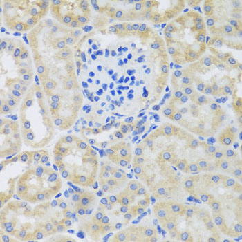 Rabbit anti-BNIP3 Polyclonal Antibody