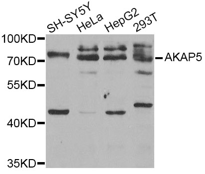 Rabbit anti-AKAP5 Polyclonal Antibody
