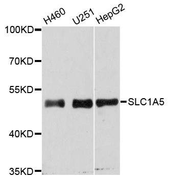 Rabbit anti-SLC1A5 Polyclonal Antibody