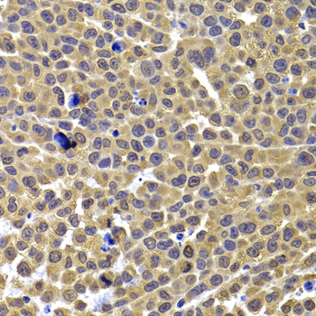 Rabbit anti-ARID3A Polyclonal Antibody