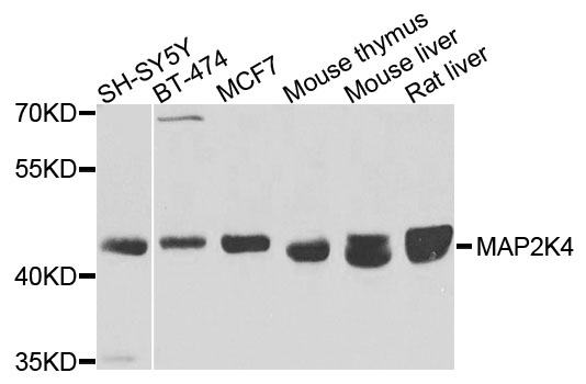 Rabbit anti-MAP2K4 Polyclonal Antibody