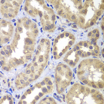 Rabbit anti-MAP2K4 Polyclonal Antibody
