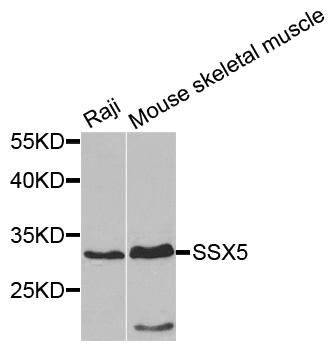 Rabbit anti-SSX5 Polyclonal Antibody
