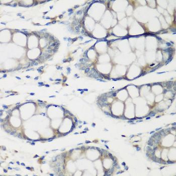 Rabbit anti-TNNC2 Polyclonal Antibody