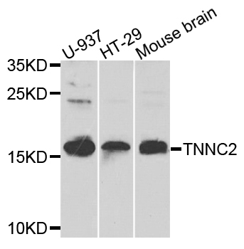 Rabbit anti-TNNC2 Polyclonal Antibody