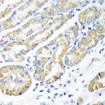 Rabbit anti-MSRB2 Polyclonal Antibody