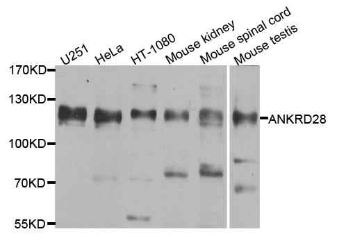 Rabbit anti-ANKRD28 Polyclonal Antibody