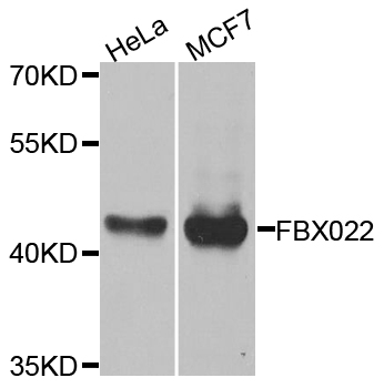 Rabbit anti-FBXO22 Polyclonal Antibody