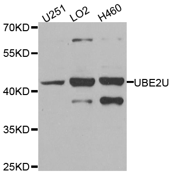 Rabbit anti-UBE2U Polyclonal Antibody