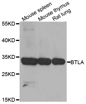Rabbit anti-BTLA Polyclonal Antibody