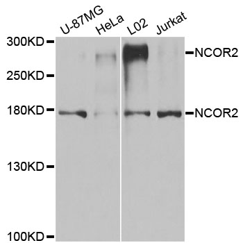 Rabbit anti-NCOR2 Polyclonal Antibody