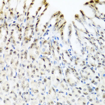 Rabbit anti-YTHDF3 Polyclonal Antibody