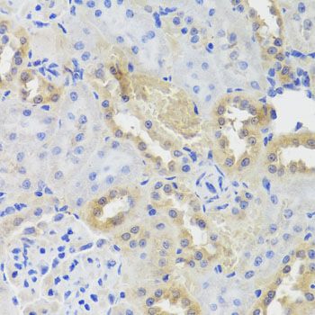 Rabbit anti-CTSC Polyclonal Antibody