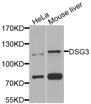 Rabbit anti-DSG3 Polyclonal Antibody