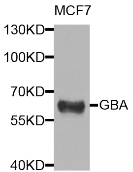 Rabbit anti-GBA Polyclonal Antibody