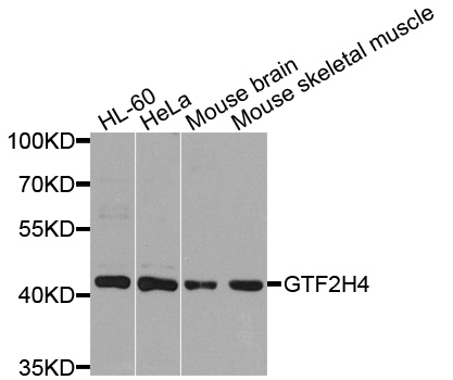 Rabbit anti-GTF2H4 Polyclonal Antibody