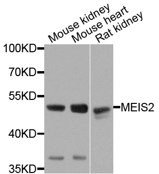 Rabbit anti-MEIS2 Polyclonal Antibody