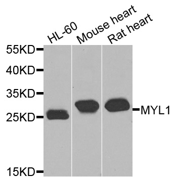 Rabbit anti-MYL1 Polyclonal Antibody