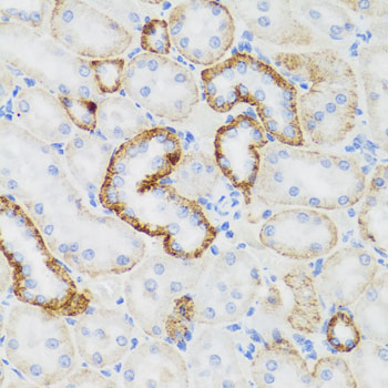 Rabbit anti-NEFH Polyclonal Antibody