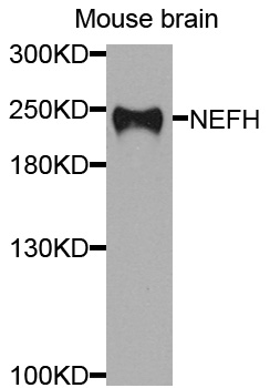 Rabbit anti-NEFH Polyclonal Antibody