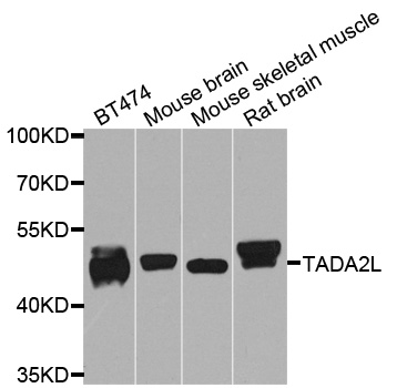 Rabbit anti-TADA2A Polyclonal Antibody