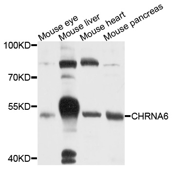 Rabbit anti-CHRNA6 Polyclonal Antibody