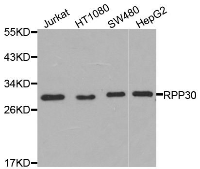 Rabbit anti-RPP30 Polyclonal Antibody