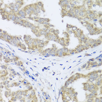 Rabbit anti-TIMM10B Polyclonal Antibody